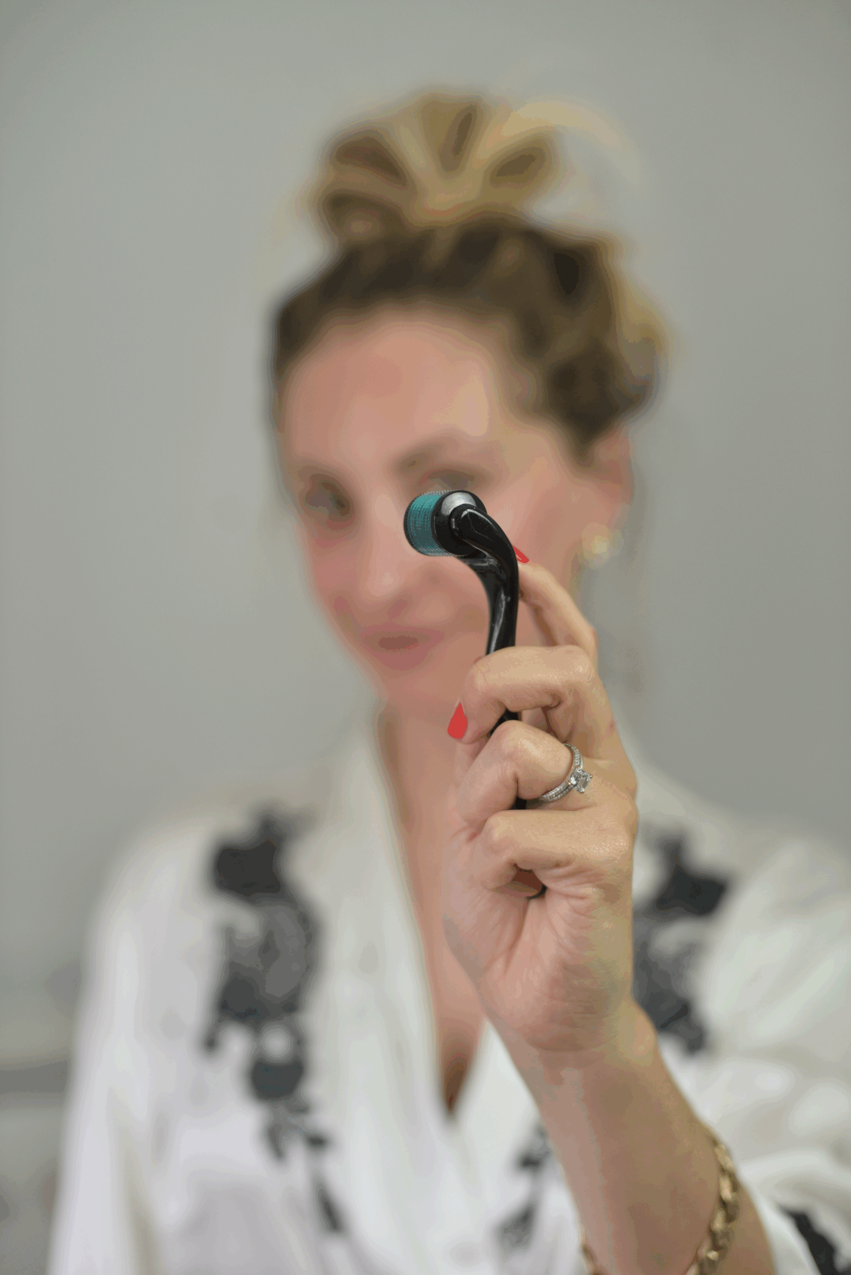How My Skin Has Changed Since I Started Derma-Rolling